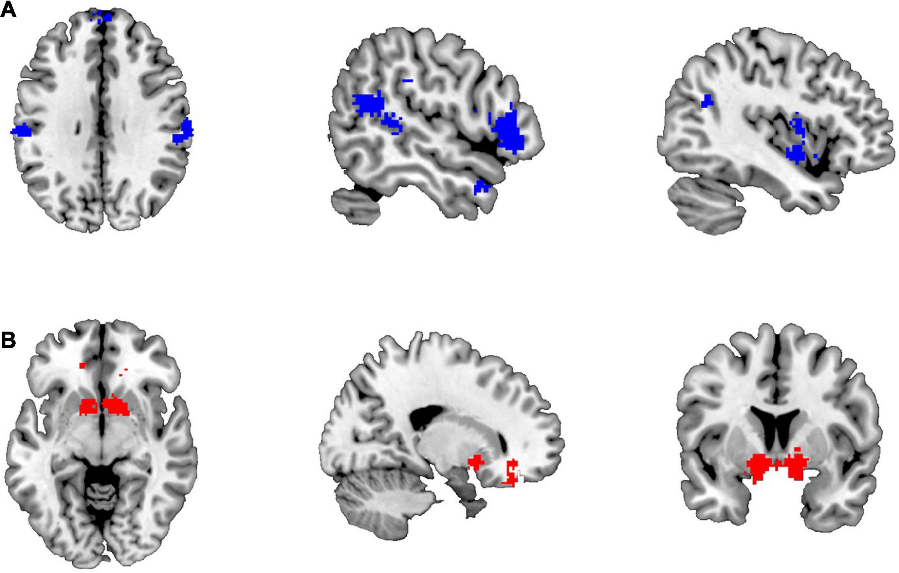 Altered hierarchical organization between empathy and gambling networks in disordered gamblers